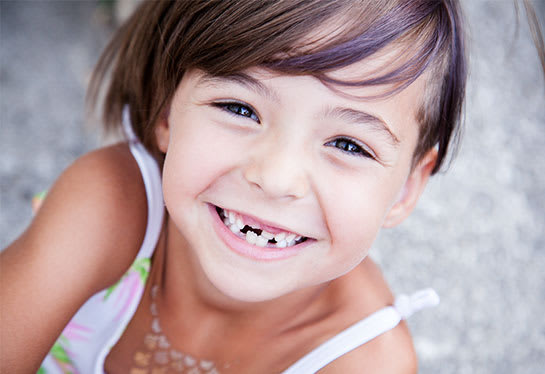 Invisalign Clear Aligners,  Gatineau Dentist