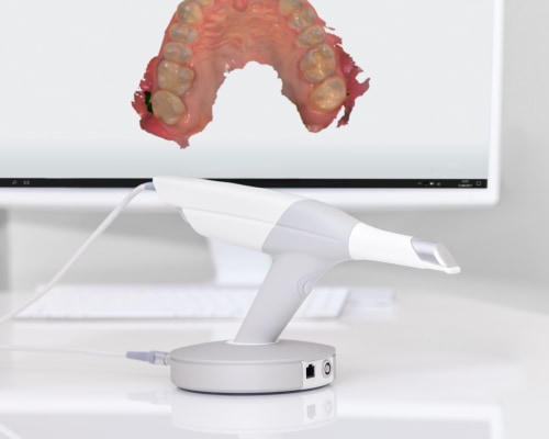 3D Treatment Plan | Clinique Dentaire Gatineau | Gatineau Dentist